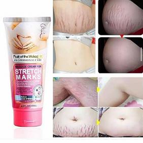 این-کرم-ترک-های-ناشی-از-چاقی-لاغری-یا-حتی-بارداری-رو-برطرف-میکنه-و‌پوستتون-رو-لطیف-و‌صاف-و‌یکدست-میکنه-